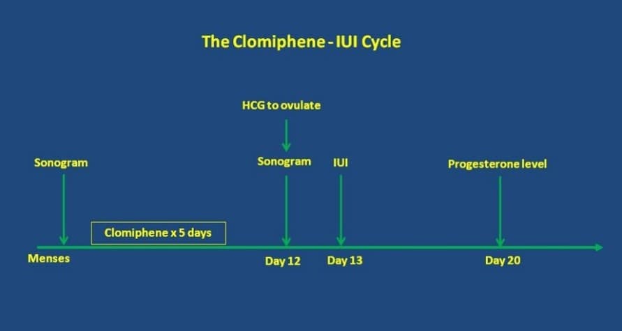 Ovluation Induction IUI Cycle