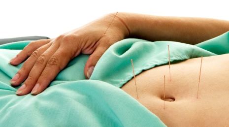 Acupuncture and infertility