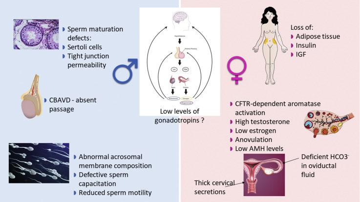 Cystic fibrosis infertility