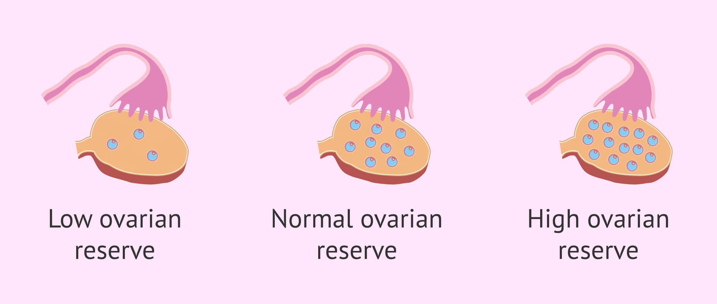 Diminished Ovarian Reserve